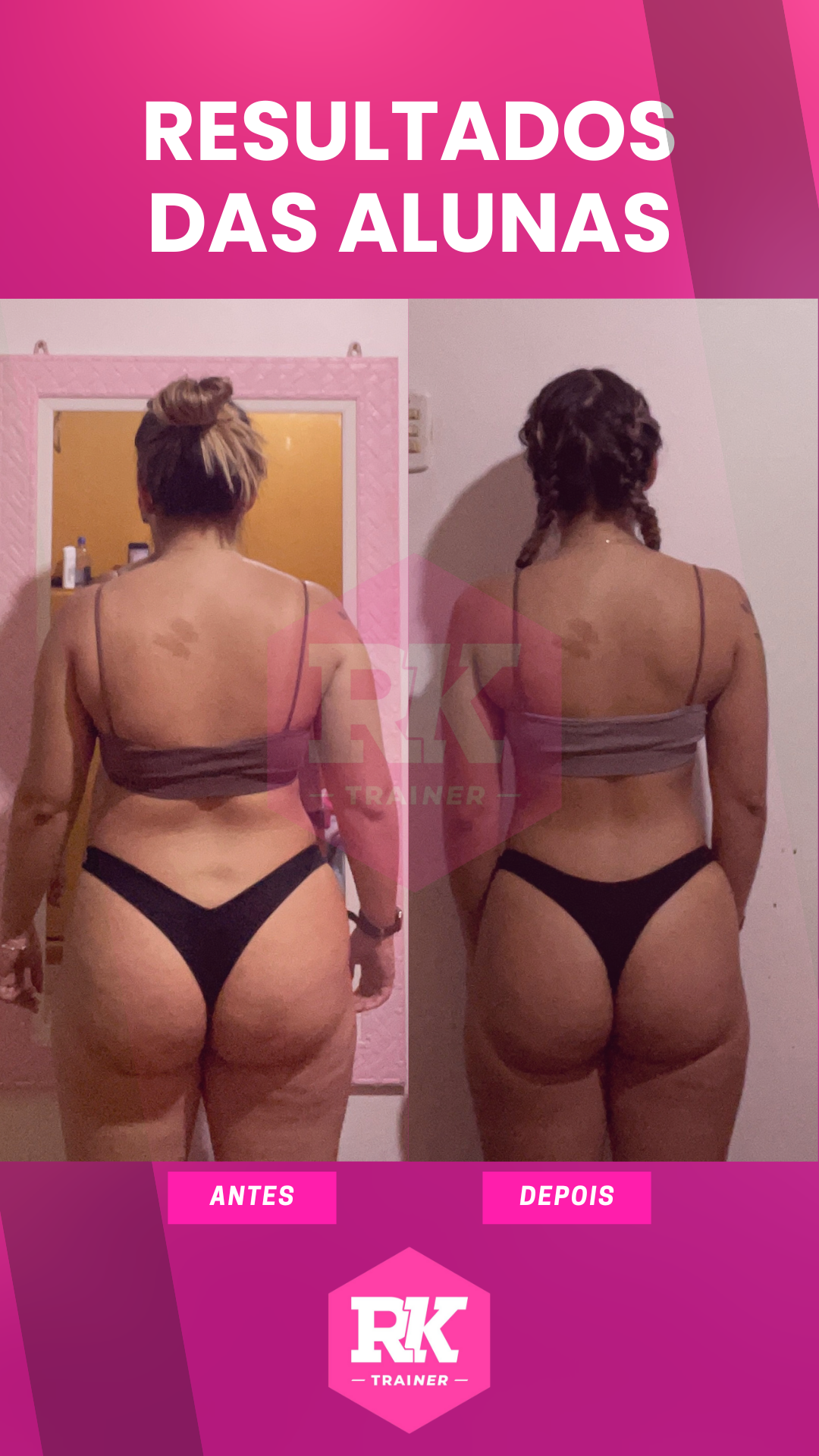 Antes e Depois Juliana Liska 2