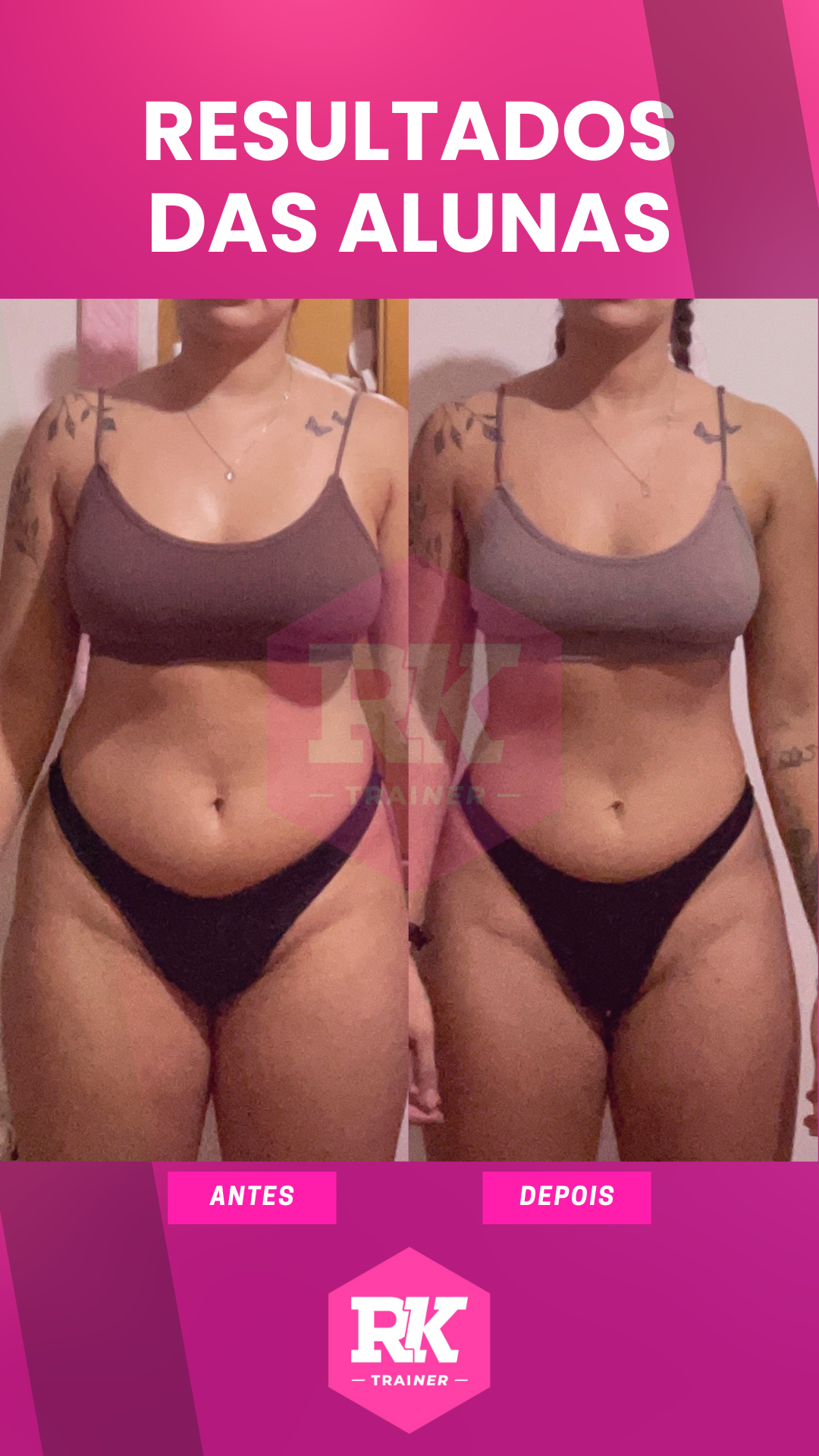 Antes e Depois Juliana Liska